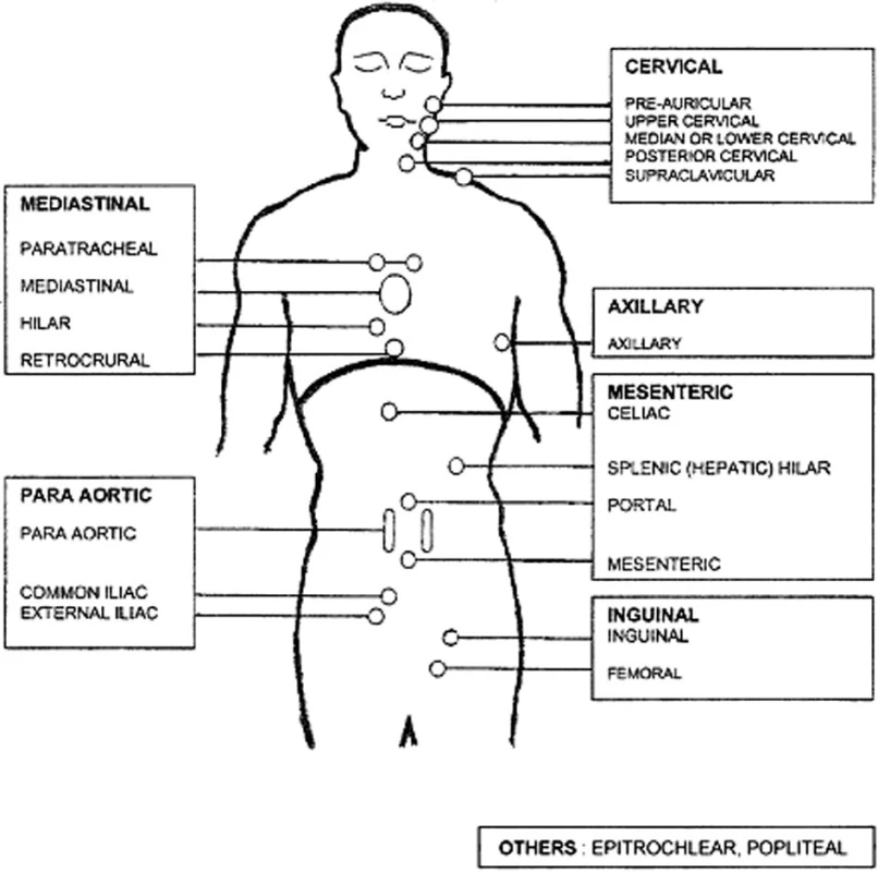 Schéma uzlinových lokalit k výpočtu rizika pro FLIPI index. Podle: Solal-Céligny et al., Blood 2004.