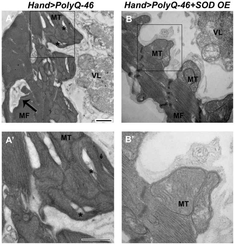 Mitochondrial ultrastructural defects in mutant Poly-Q expressing hearts are suppressed with SOD over-expression.