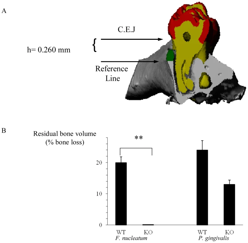 NCR1-dependent bone loss.