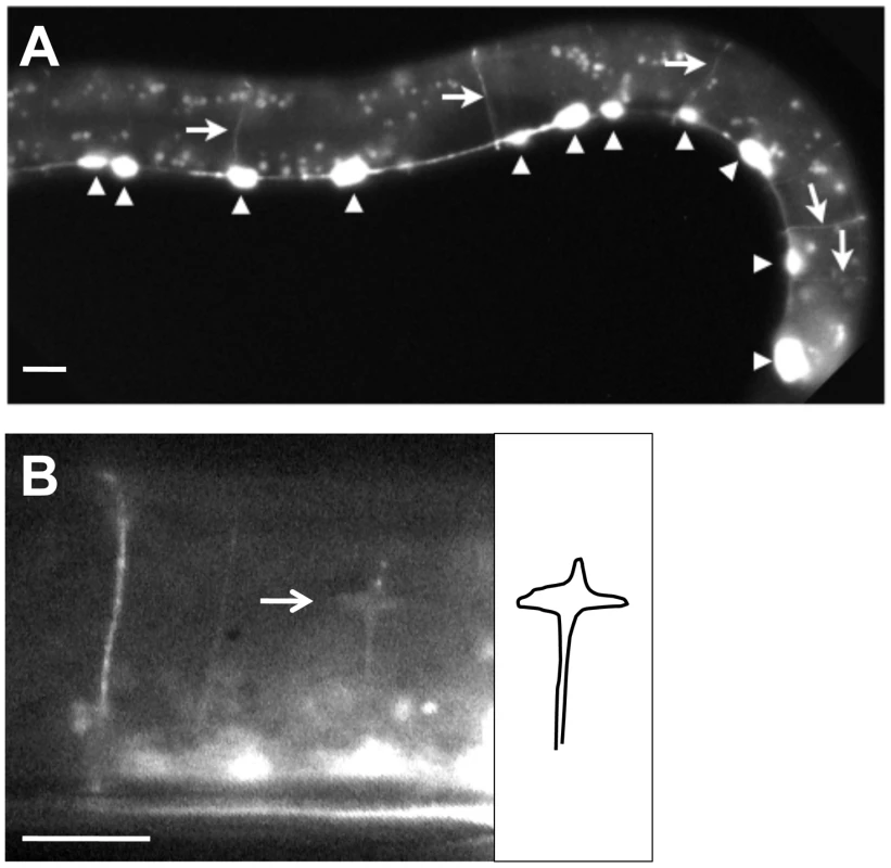 RACK-1::GFP expression in GABAergic motor neurons.