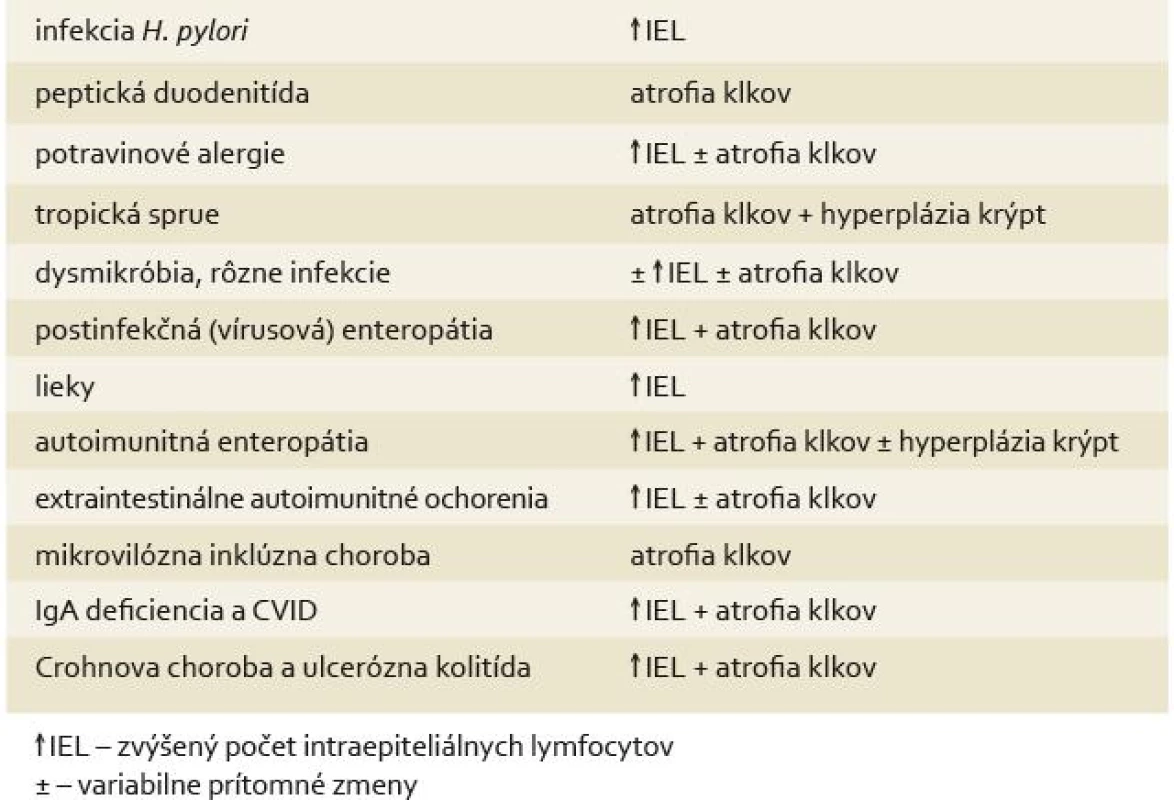 Histologická diferenciálna diagnostika céliakie.
Tab. 3. Histological differential diagnostics of celiac disease.