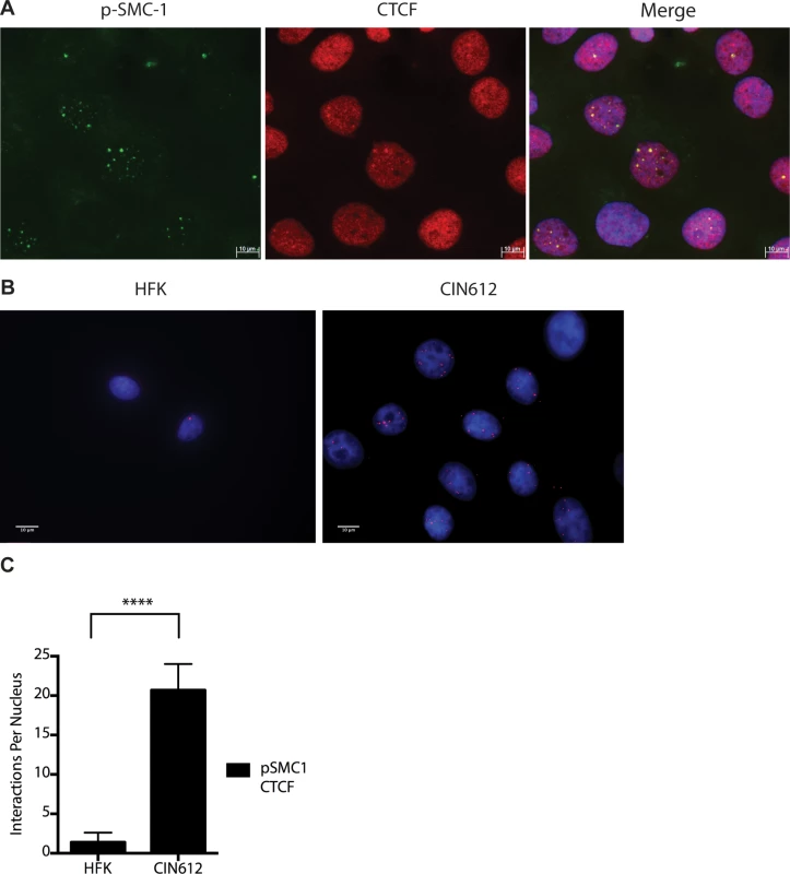 CTCF and SMC1 co-localize to nuclear foci and form complexes.