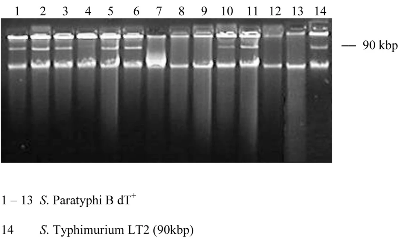 Plazmidový profil kmeňov S. Paratyphi B dT+ (S. Java).
Fig. 1. Plasmid profiles of strains of S. Paratyphi B dT+ (S. Java)