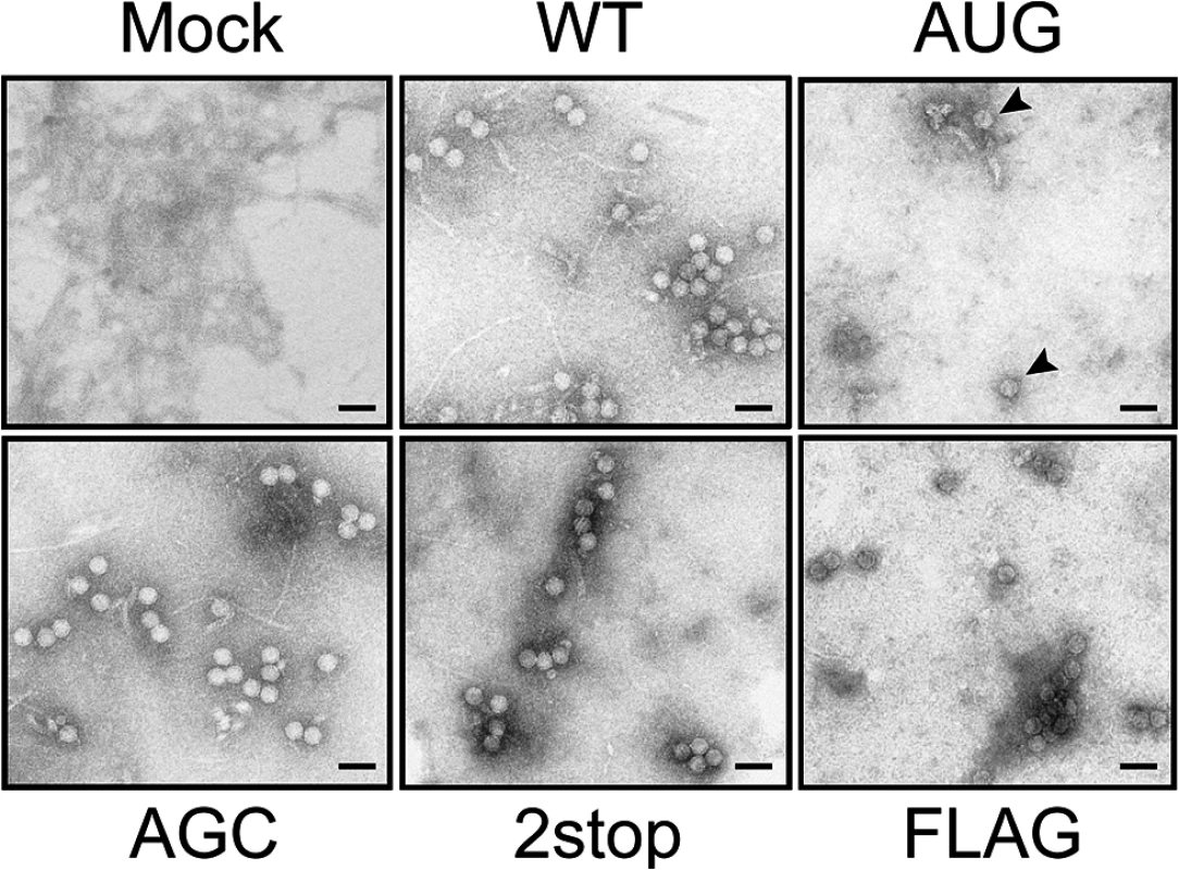 Viral particles produced by TuYV-3a mutants.