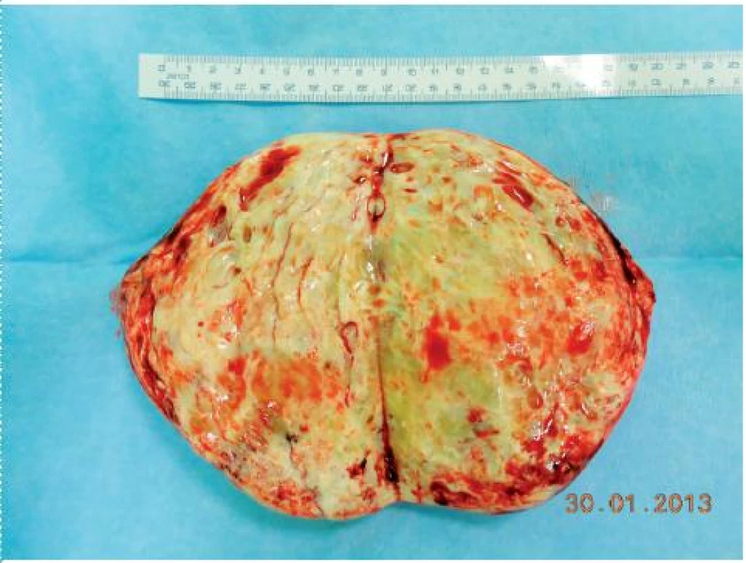 Preparát k histologickému vyšetření
Fig. 3. Pathology specimen