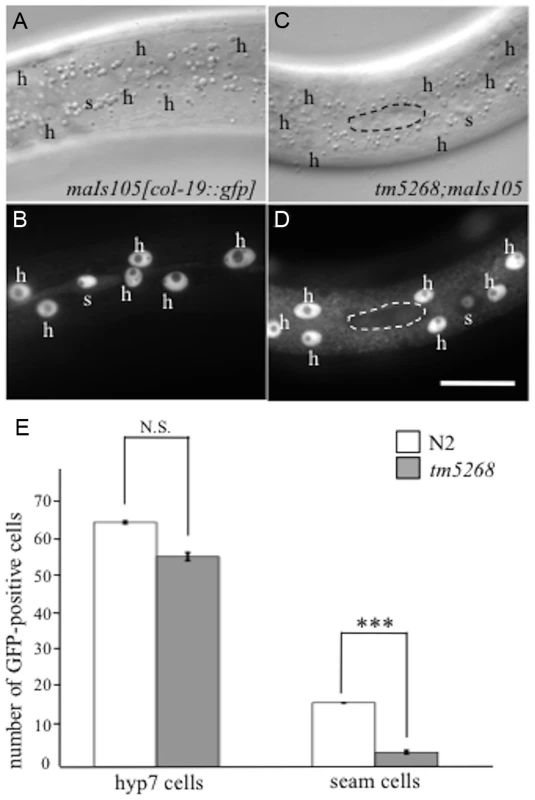 BCL-7 is involved in asymmetric cell differentiation of the epidermis in <i>Caenorhabditis elegans</i>.