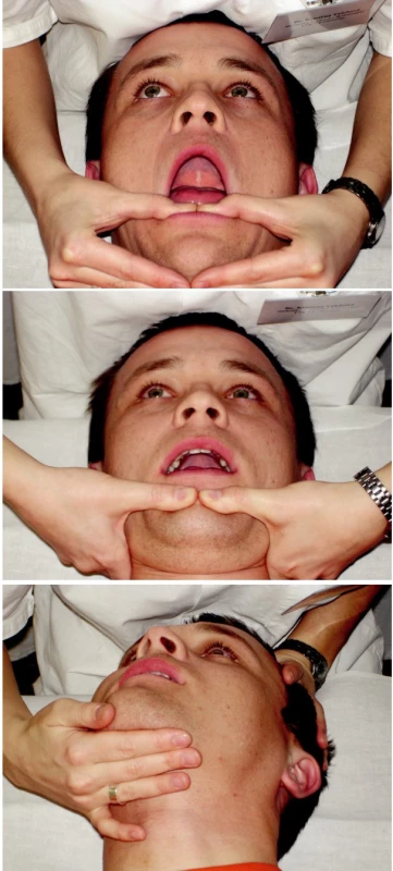 Ošetření svalů.
2a) PIR m. masseter, m. temporalis a m. pterygoideus medialis
2b) PIR protraktorů mandibuly (m. pterygoideus medialis et lateralis)
2c) PIR venter posterior m. digastricus