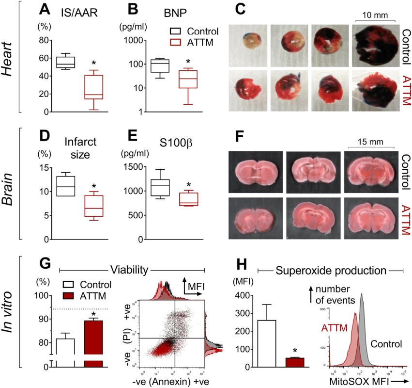 Organ-specific ischemia/reperfusion and cellular anoxia/reoxygenation.