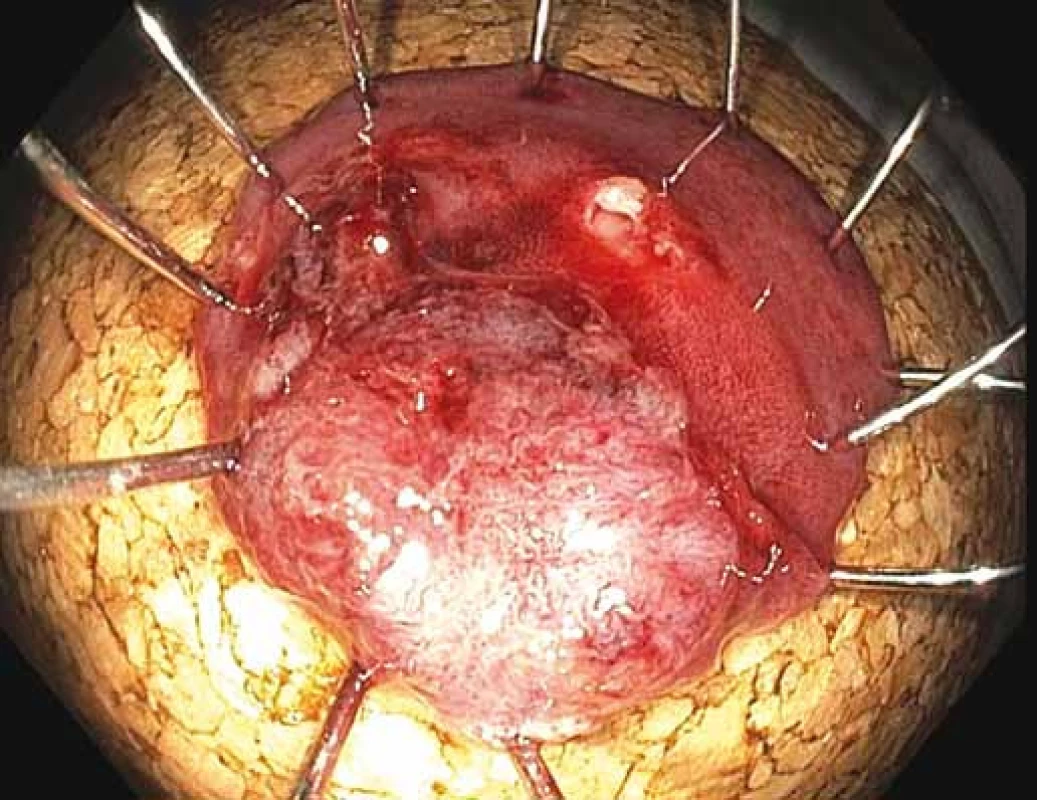 Resekát našpendlený na korkovou podložku.
Fig. 6. The biopsy pinned on a cork underlay.