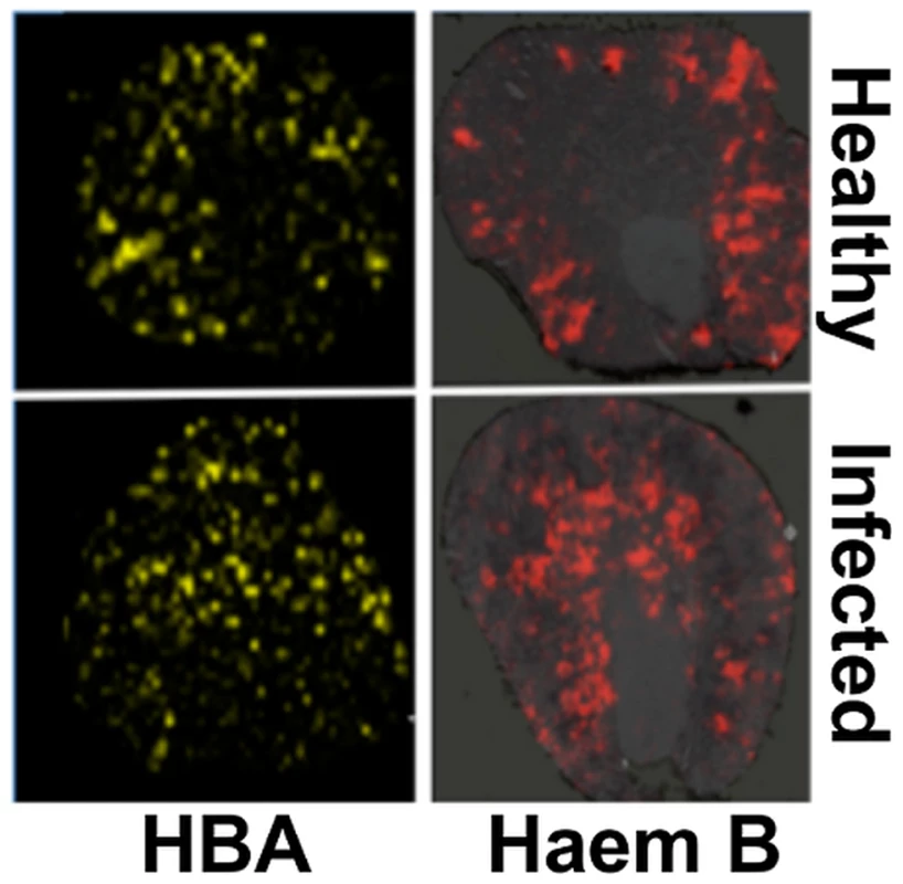 Spatial distributions of HBA and haem mirror <sup>56</sup>Fe distributions in healthy and infected kidneys.