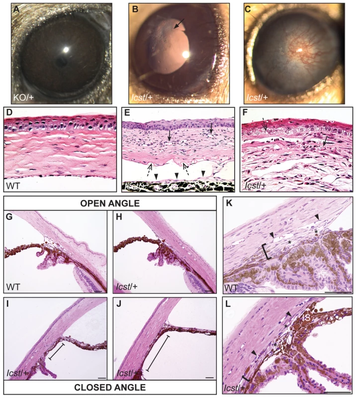 <i>Icst</i> causes defects in the anterior segment of the eye.