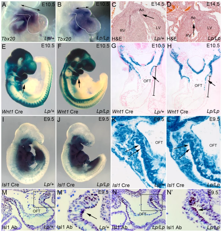 <i>Lp</i> mice display a spectrum of outflow tract abnormalities.