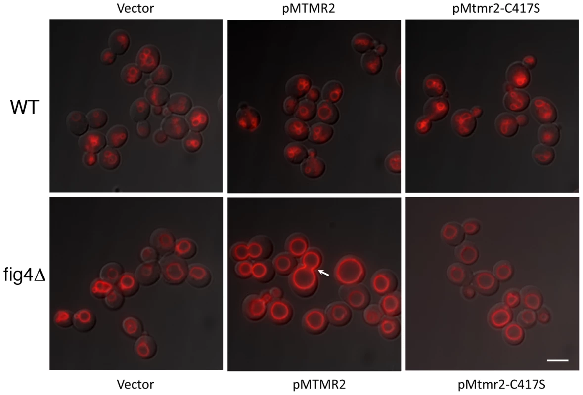 MTMR2 and FIG4 interaction in yeast.