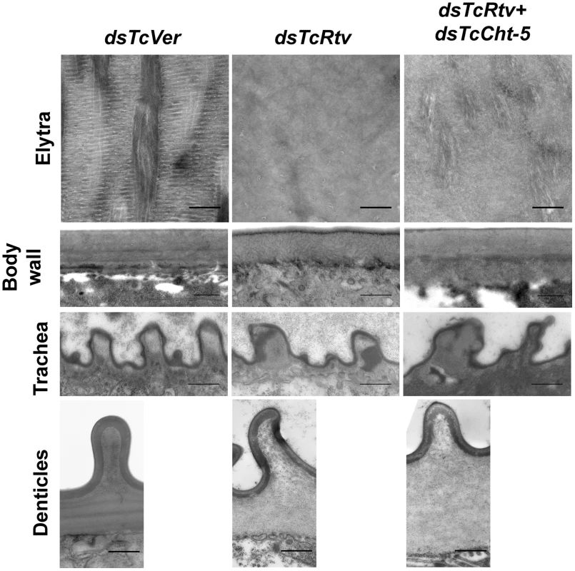 TcRtv is essential for maintenance of normal cuticle architecture.