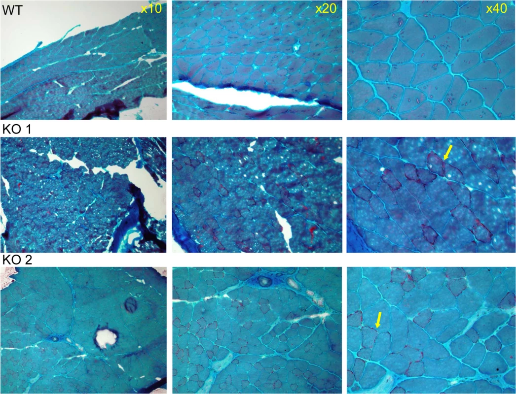 Muscle pathology of CaM KMT-/- mice demonstrated by Gomori-Trichrome staining.