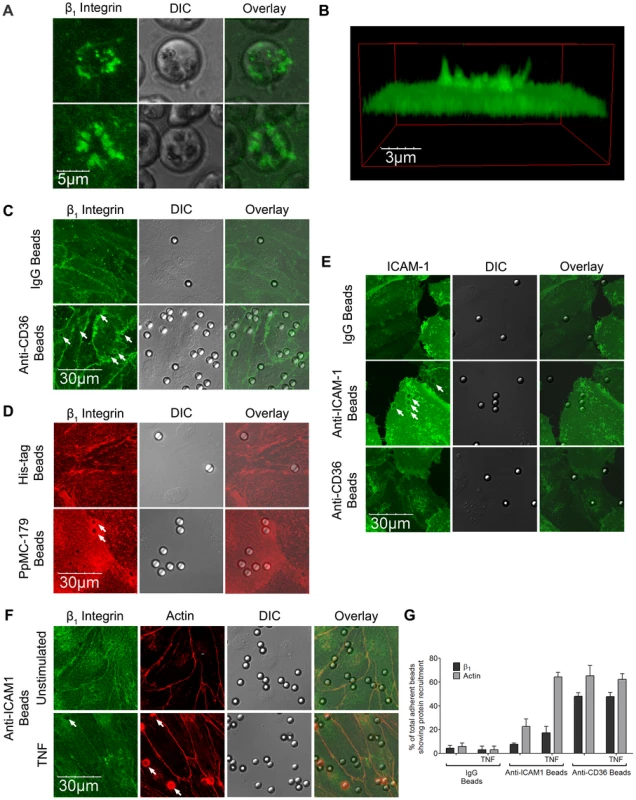 β<sub>1</sub> integrin recruitment by adherent IRBC, antibody- or PpMC-179 coated-beads.