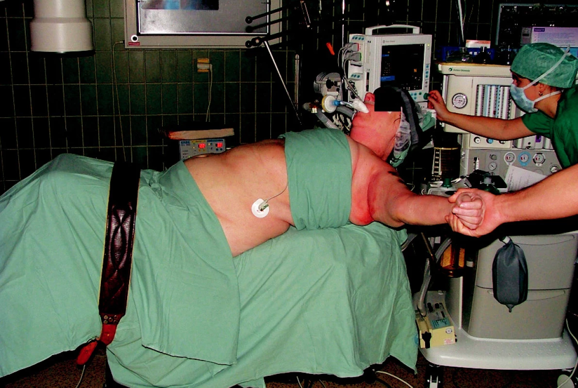 Foto – poloha pacienta na operačním stole před zahájením operace
Fig. 9. A patientes positioning on the operating table prior to surgery