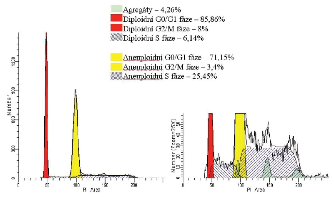 Analýza DNA. Jednoparametrický histogram znázorňuje na ose x intenzitu signálu související s množstvím navázaného fluorescenčního barviva propidium iodidu (PI) a na ose y množství buněk. Cytometrická analýza DNA je založená na schopnosti PI vázat se stechiometricky na nukleové kyseliny. Pokud je barvivo podáno v nadbytku, je intenzita fluorescence jednotlivých buněk přímo úměrná obsahu DNA v buňce. U diploidních buněk v G0/G1 fázi je poloviční ve srovnání s buňkami v G2/M fázi. U S fáze, díky tomu, že dochází k syntéze DNA, se fluorescence buněk zvyšuje. Cytometrista však není schopen pomocí této metody odlišit buňky v G0 fázi od buněk v G1 fázi, stejně jako buňky v G2 fázi od buněk v M fázi, jelikož obsah DNA je ve srovnávaných fázích cyklu stejný.
Uvedený histogram ilustruje směs diploidních a aneuploidních buněk izolovaných z tkáně suspektního non-Hodkinského lymfomu, které se liší obsahem DNA a proliferační aktivitou. Diploidní buňky (znázorněny červeně) vykazují nižší proliferační index (součet buněk v S a G2/M fázi) než aneuploidní buňky (znázorněny žlutûě, které mají kromě vyššího proliferačního indexu i vyšší obsah DNA díky chromozomálním aberacím. Analýza DNA zjistila vysokou proliferační aktivitu vyšetřovaných diploidních i aneuploidních buněk a prokázala chromozomální aberace, což nasvědčuje vysoce malignímu procesu. Nález byl v korelaci s imunofenotypizací průtokovu cytometrií a histologickým vyšetřením, které prokázaly infiltraci tkáně velkobuněčným lymfomem (DLBCL).