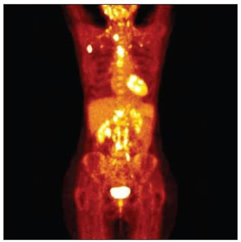 PET/CT
Fig. 7. PET/CT