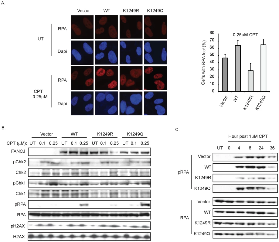 FANCJ and its acetylation at 1249 promote an RPA response.