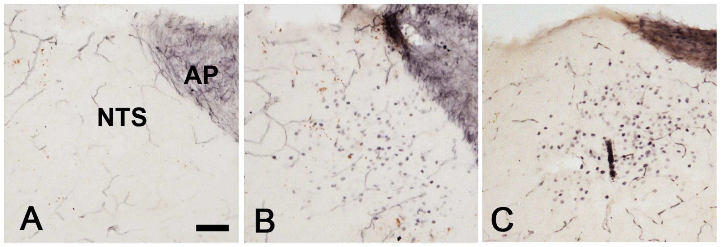 Brain activation in response to rotavirus infection.