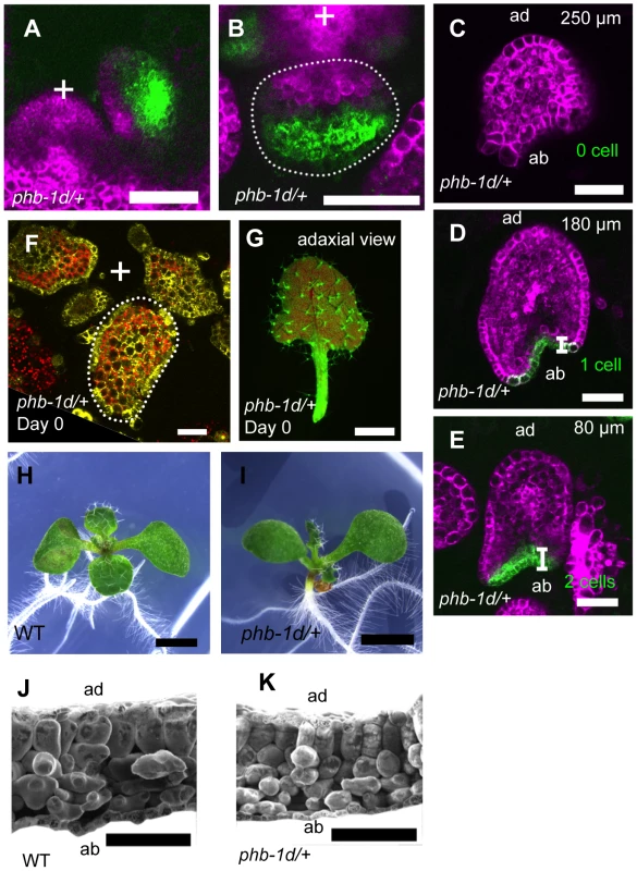 FMB shifting is quicker in the <i>phb-1d/+</i> mutant than in the wild type.