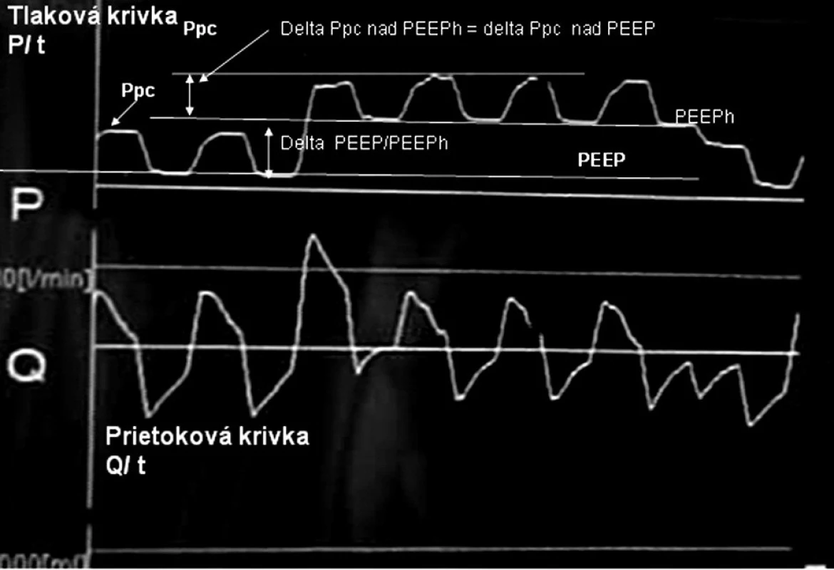 Priebeh tlakovej a prietokovej krivky odfotenej z obrazovky ventilátora Šípkami sú znázornené hodnoty jednotlivých nastavovaných parametrov.