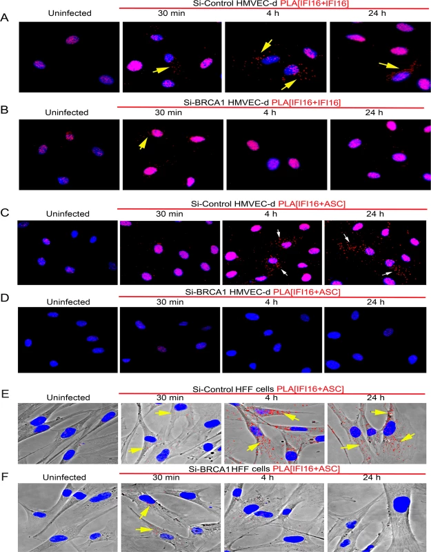 PLA analysis demonstrating the importance of BRCA1 for IFI16 and ASC complex formation and redistribution of IFI16 and IFI16-ASC complex during KSHV infection.