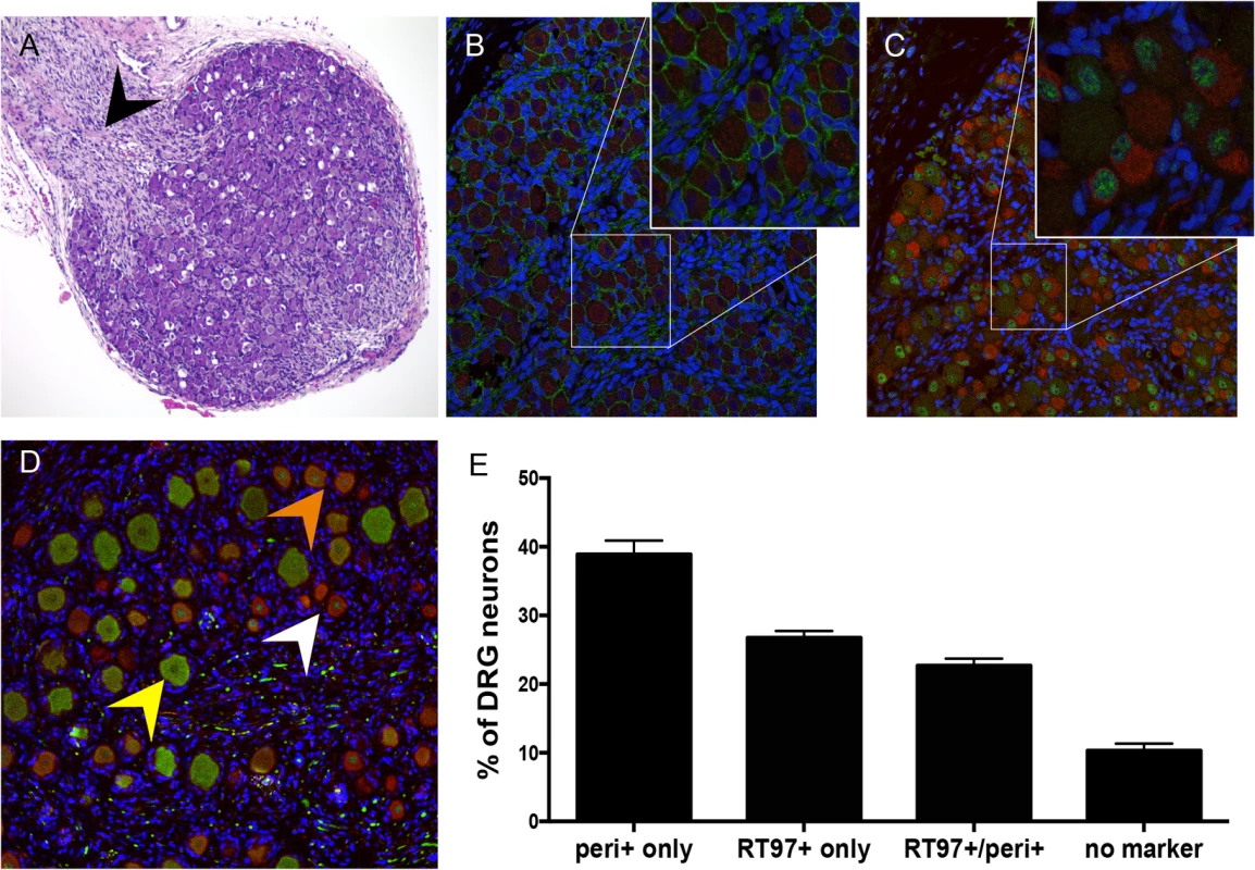 Differentiation of neurons after DRG implantation.