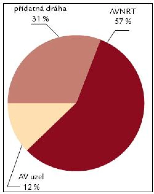 Spektrum RFA 1997. Obr. 7–9 ukazují změnu spektra indikací ke katetrové ablaci na IKK FN Brno v průběhu období 1995–2010. AVNRT – atrioventrikulární nodální reentry tachykardie, AV uzel – neselektivní ablace AV uzlu s implantací kardiostimulátoru, fokální ST – fokální síňová tachykardie, KT – komorová ektopie a komorová tachykardie.