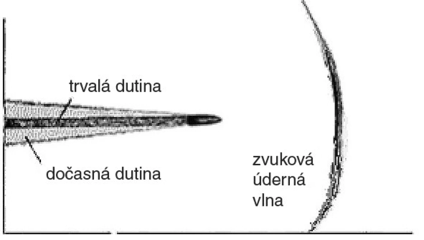 Mechanismus vzniku střelného poranění a formování dočasné a trvalé dutiny
Fig. 1. Gunshot wound mechanism and forming of temporary and permanent cavity