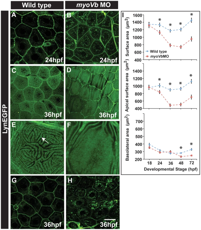 Effect of loss of <i>myosin Vb</i> function on membrane projections, cell size and cell surface area.