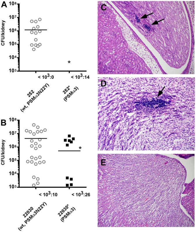 The PSMα3 variation significantly impacts virulence of CC30 MRSA in experimental blood infection.