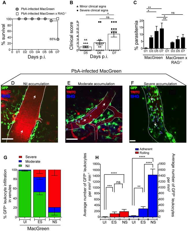 Visualizing the behaviour of GFP<sup>+</sup> leukocytes in the brain microvasculature.