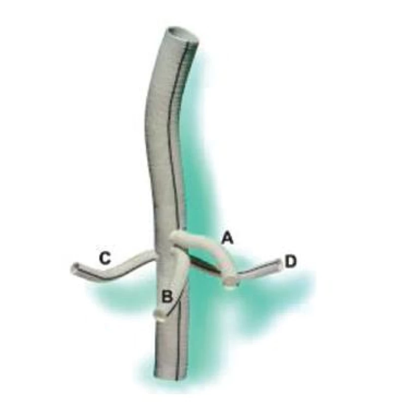 Větvená cévní protéza (A – truncus coeliacus, B – arteria mesenterica superior, C – arteria renalis dextra, D – arteria renalis sinistra)
Fig. 13. Branched vascular prosthesis (A – truncus coeliacus, B – arteria mesenterica superior, C – arteria renalis dextra, D – arteria renalis sinistra)