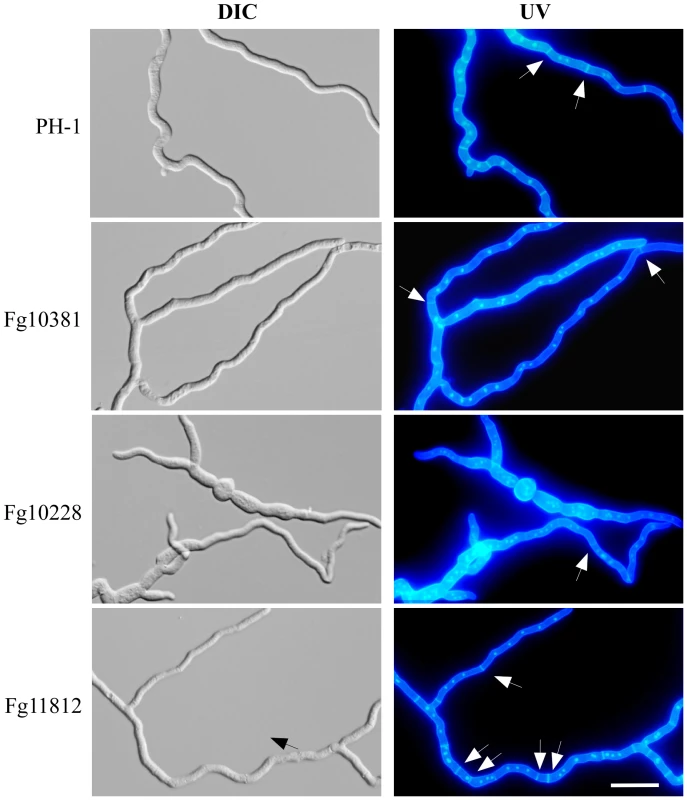 Septation defects in the Fg10228, Fg11812, and Fg10381 mutants.