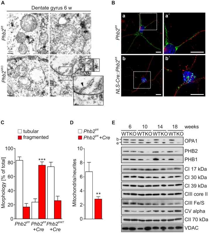 Defective mitochondrial morphogenesis and ultrastructure in <i>Phb2</i>-deficient neurons <i>in vivo</i>.