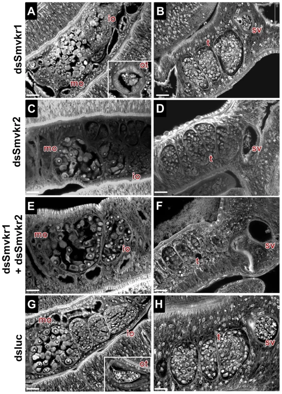 Morphological analysis of reproductive organs from worms treated with dsSmvkr1 or dsSmvkr2 RNA.