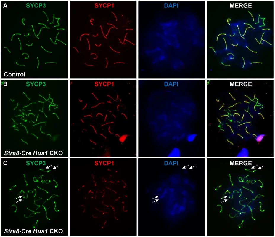 Conditional <i>Hus1</i> knockout meiotic chromosomes display synapsis defects and ruptures in the synaptonemal complex.