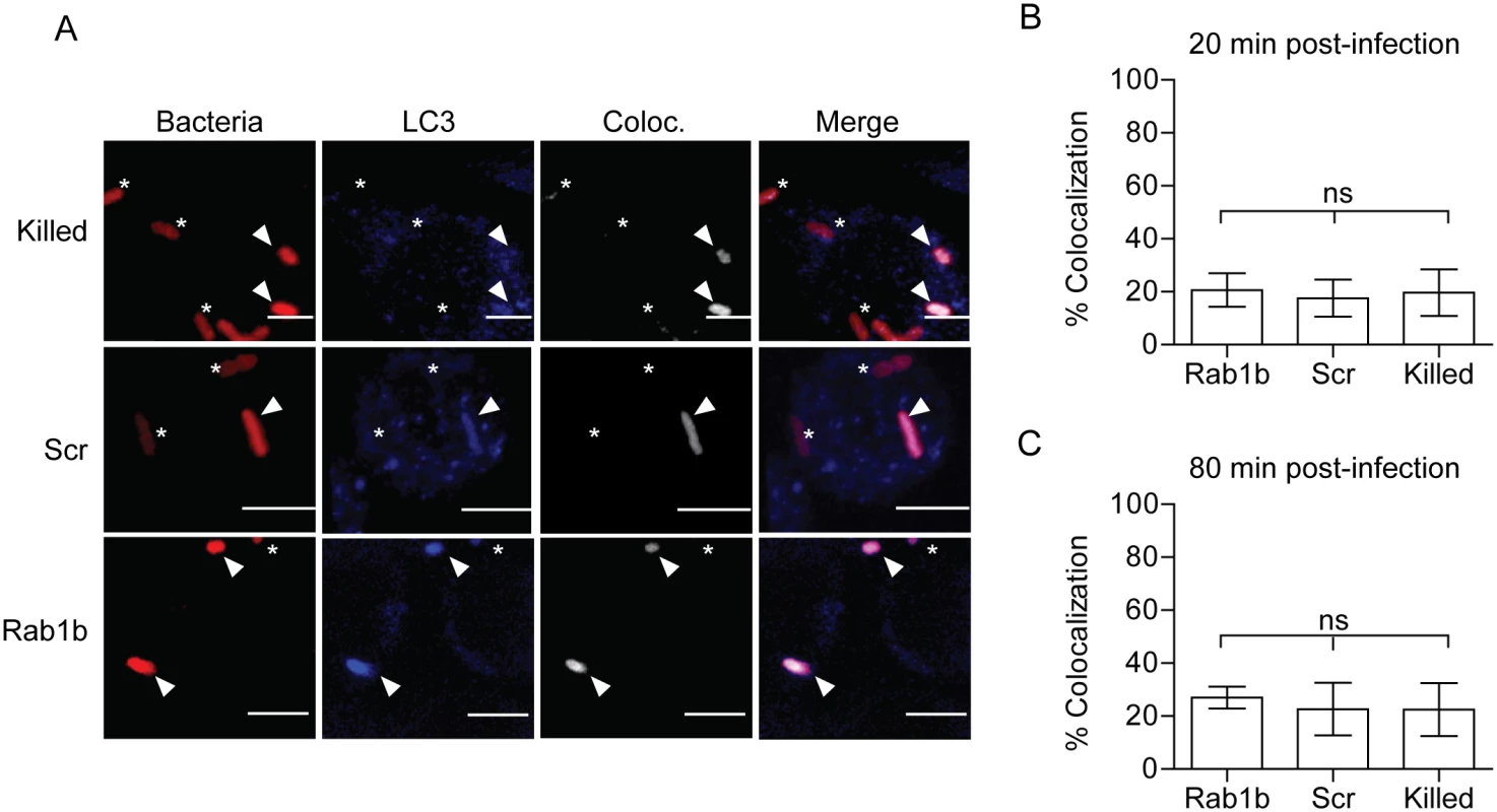 Rab1b knockdown does not affect YCV association with LC3.