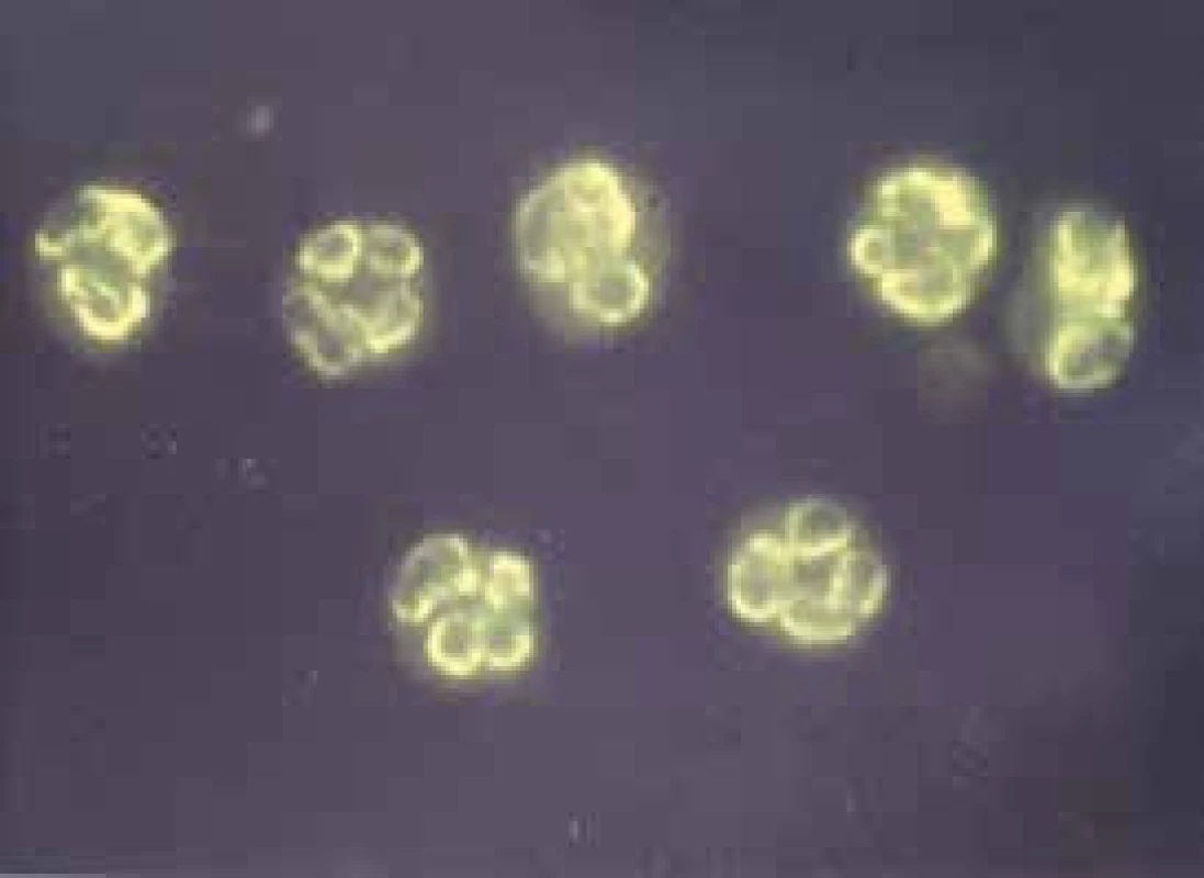 pANCA protilátky – perinukleární typ imunofluorescence