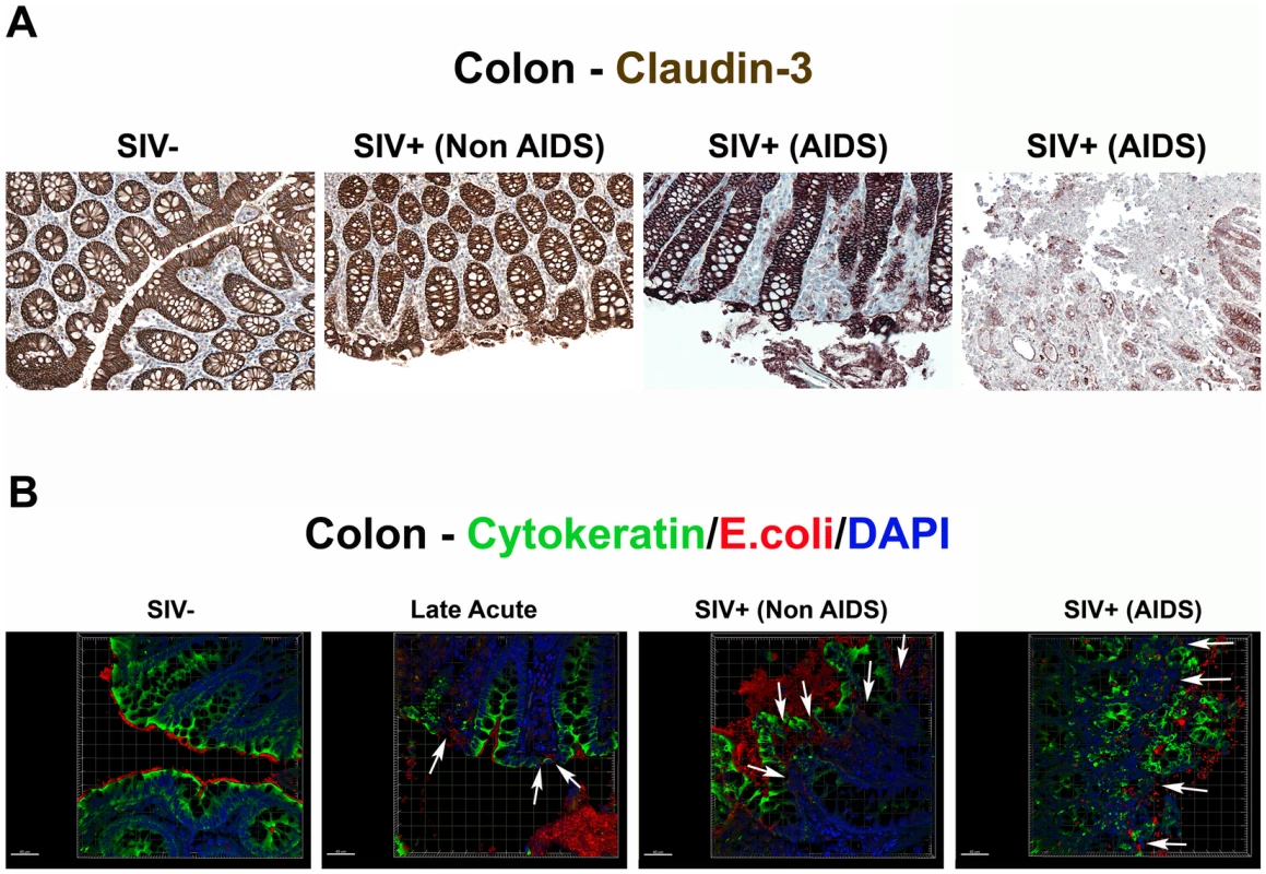 Damage to the integrity of the epithelial barrier is associated with infiltration of microbial products into the lamina propria.
