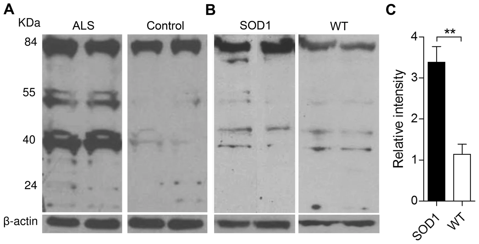 Expression of Oxr1 in ALS and ALS-related neurodegeneration.