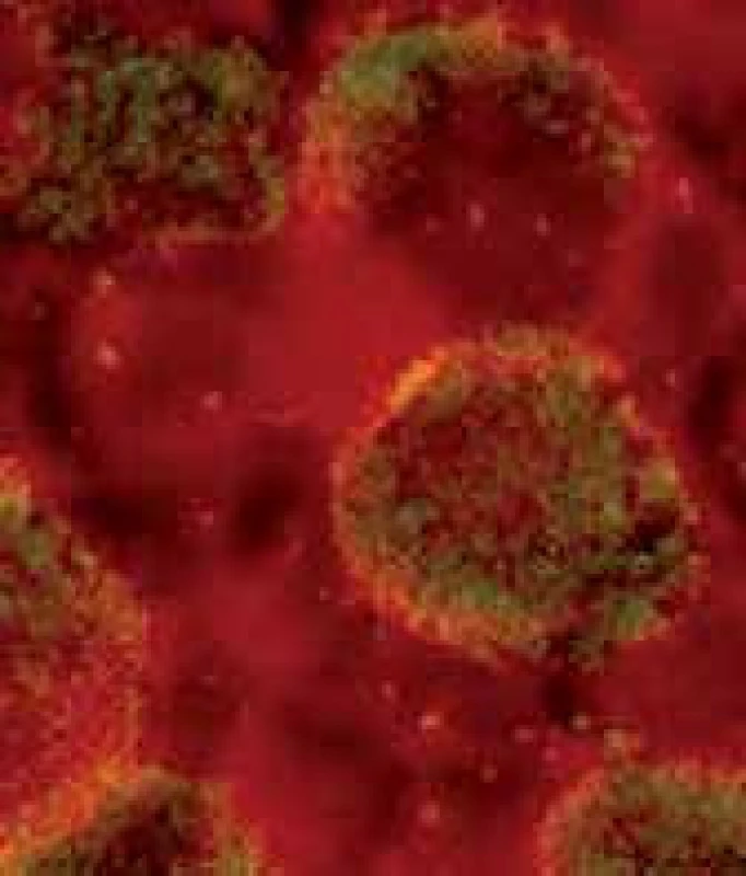 Chlamydia trachomatis.