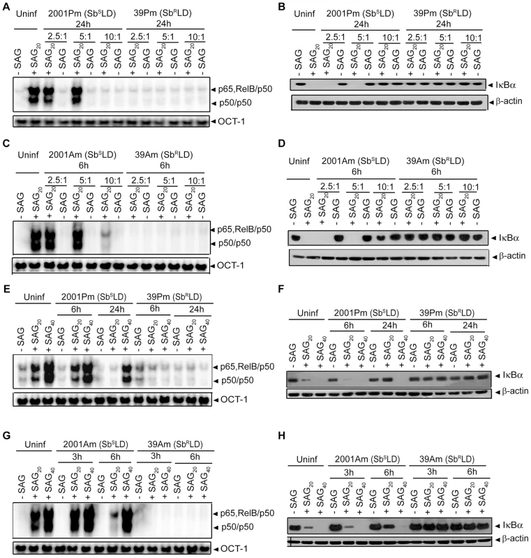 SAG-induced NF-κB activation is restored in Sb<sup>S</sup>LD- but not Sb<sup>R</sup>LD-infected DCs despite prolonged infection.
