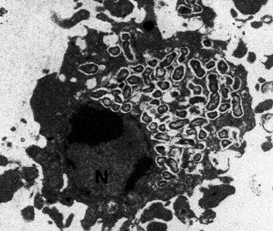 Monocyto-makrofágová buňka infikovaná Francisella tularensis (poskytla RNDr. Z. Kročová, Ústav molekulární patologie, FVZ UO, Hradec Králové).
Fig. 1. Monocyto-macrophage cell infected with Francisella tularensis (courtesy of Dr. Z. Kročová,
Institute of molecular pathology, FVZ UO, Hradec Králové).