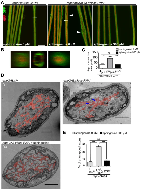 Sphingosine rescues the glial bulging phenotype.