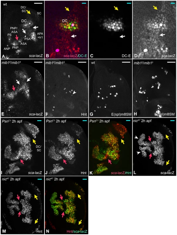 Loss of Notch pathway activity reveals the existence of a proneural band in the notum.