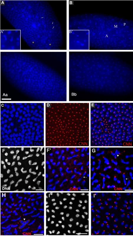 <i>xpd<sup>eE</sup></i> embryos show nuclear division defects, loss of division synchrony, and chromosomal instability.