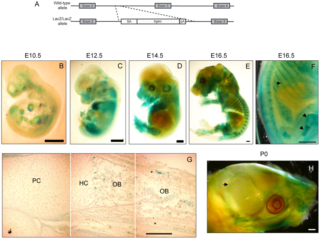 Prdm5 is expressed in osteoblast regions of developing bones.